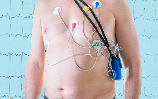 Holter EKG