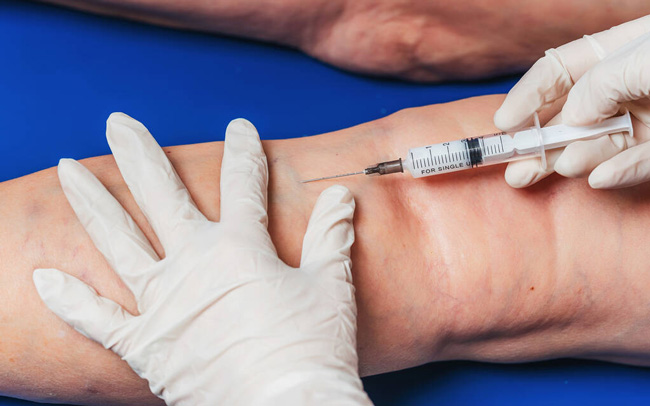 Intraartiklularna injekcija - blokada zglobova sa pregledom ortopeda